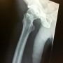 Just thought I should let u guys know I got a X-ray of my hip last night
